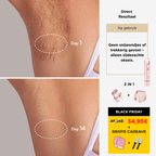 2-in-1 Lichaamsscheermes voor vrouwen